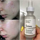The Ordinary Niacinamide 10% + Zinc 1 % – 30ml
